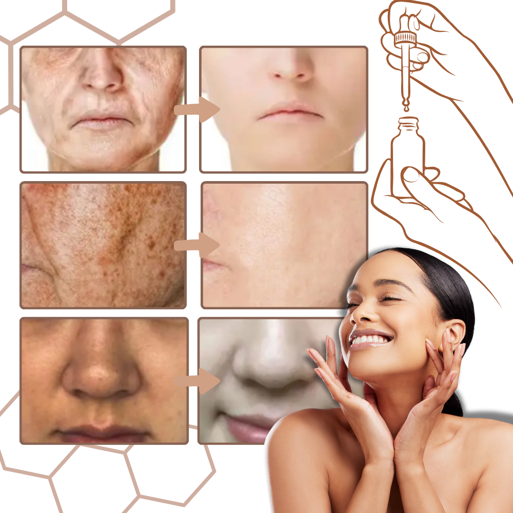 Non-Greasy Melanin Correcting Facial Serum - Ozerty