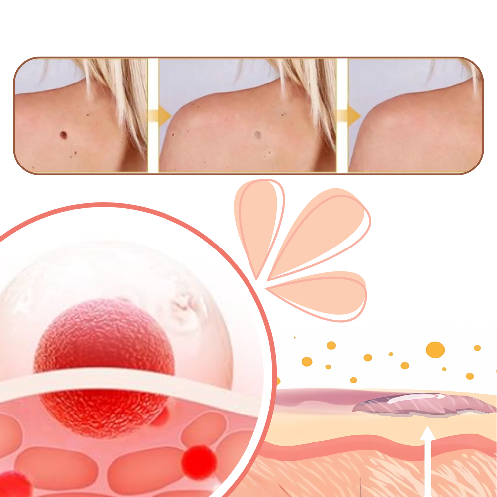 Non-Invasive Tag Recede  - Ozerty